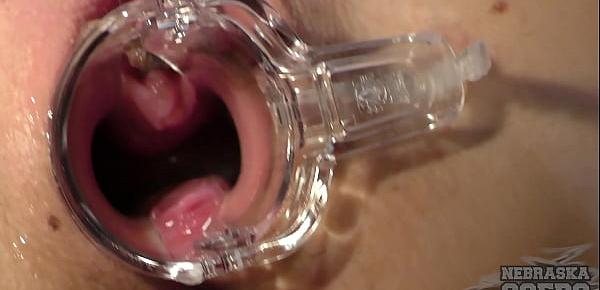  dp anal toy with speculum opening up young fresh brunettes vagina
